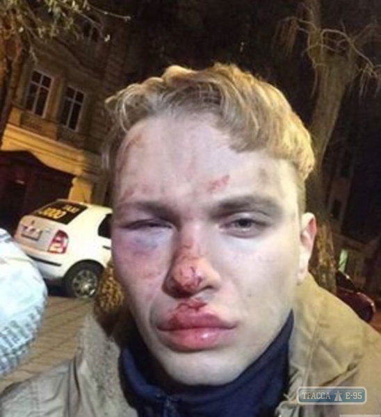 В Одессе избили и ограбили молодого певца 