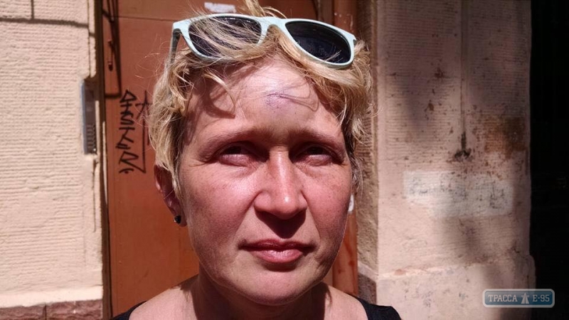 Руководство полиции взяло под личный контроль дело о нападении на активистку в центре Одессы