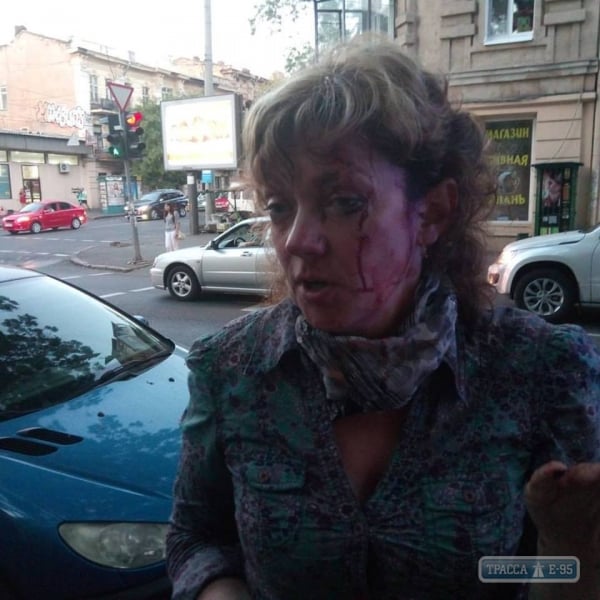 В центре Одессы напали на известную активистку