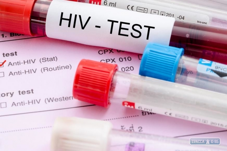 Менее трети ВИЧ-инфицированных в Одесской области получают антивирусную терапию