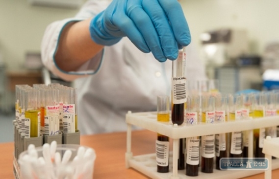 Медики зарегистрировали в Одесской области еще одну вспышку гепатита
