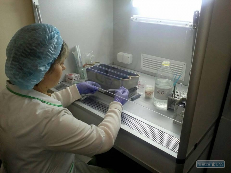 Центр диагностики туберкулеза для пациентов шести районов севера Одесской области открылся в Балте