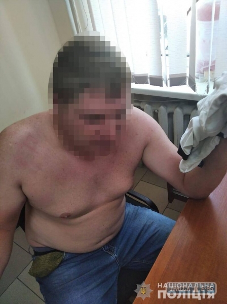 Водитель покусал полицейских в Одесской области