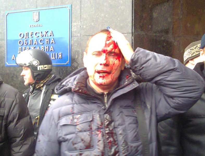 Минимум девять журналистов пострадали в драке возле здания Одесской ОГА