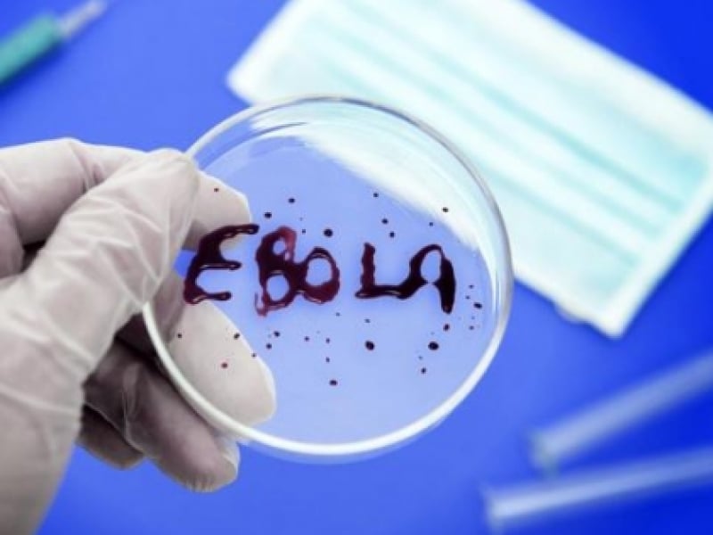 Минздрав назначил Одесский противочумный институт координатором по диагностике лихорадки Эбола