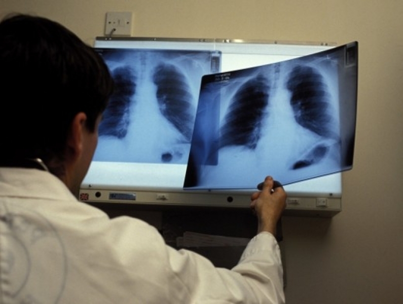 Одесские специалисты смогут выявлять туберкулез за сутки вместо трех месяцев