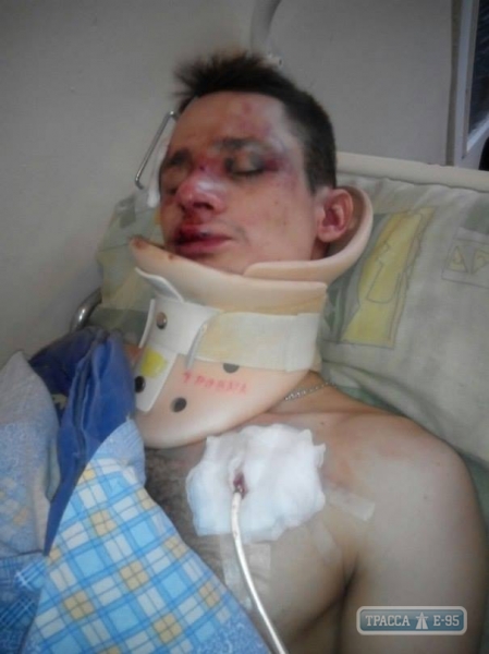 Жители Белгород-Днестровского района обвиняют депутата в жестоком избиении