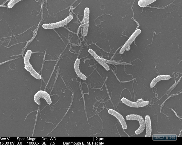 В водоемах Одесской области обнаружены холерные вибрионы