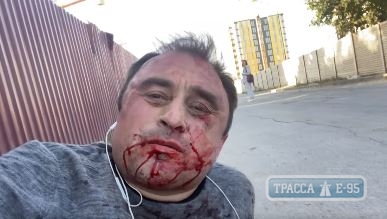 Люди в балаклавах избили экс-главу райгосадминистрации в Одесской области. Видео