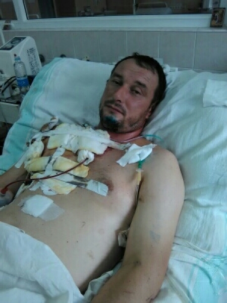 Уроженец Березовского района Одесской области тяжело ранен в бою на востоке Украины