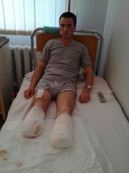 Житель Одесской области, потерявший обе ноги а АТО, едет на лечение в Германию