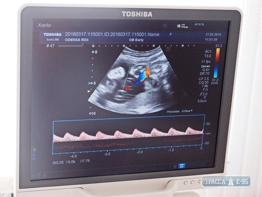 Одесский роддом №4 получил современный УЗИ-аппарат